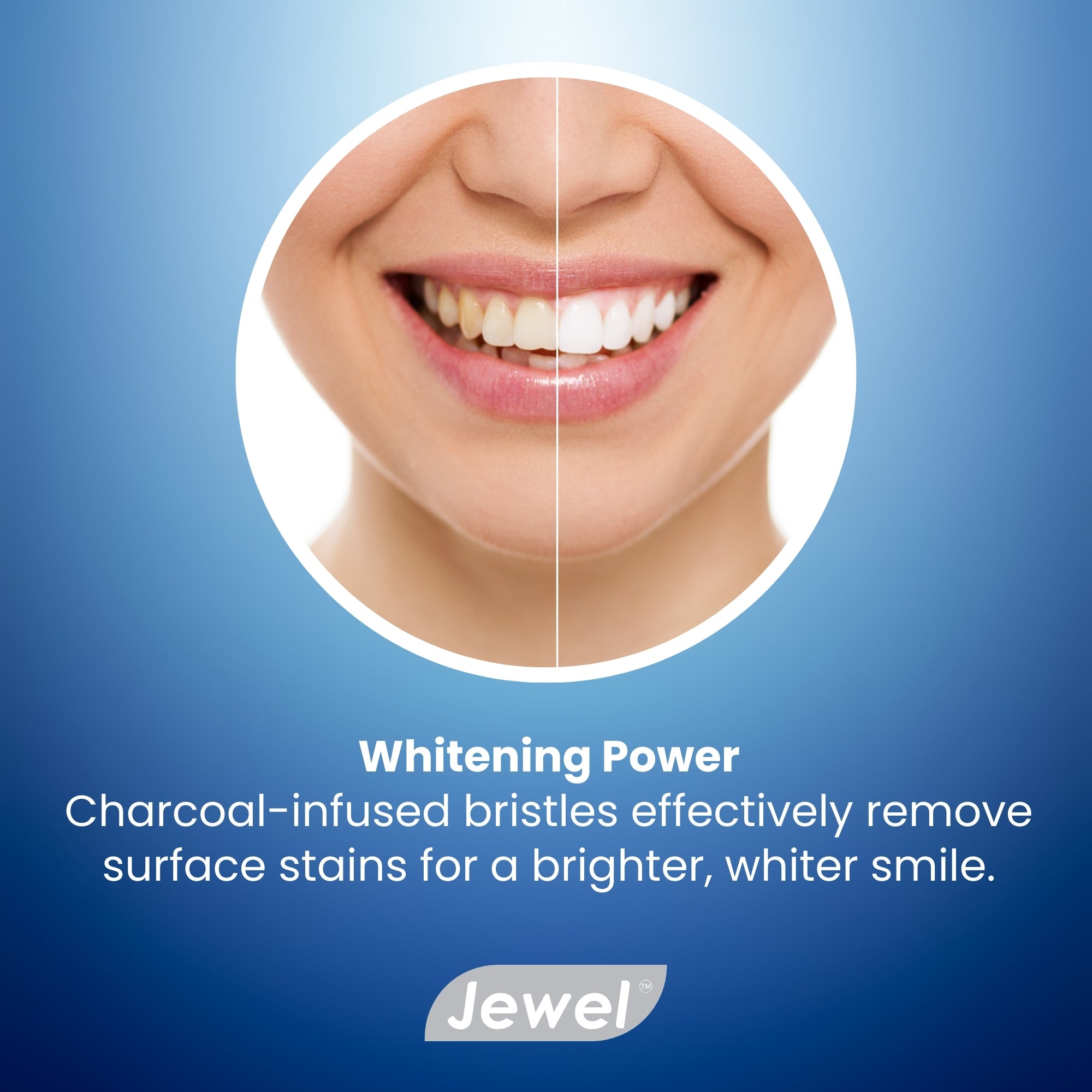 JEWEL WHITENING